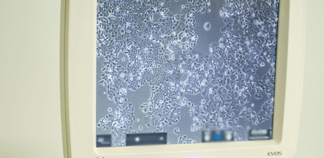 Cell Therapy Services