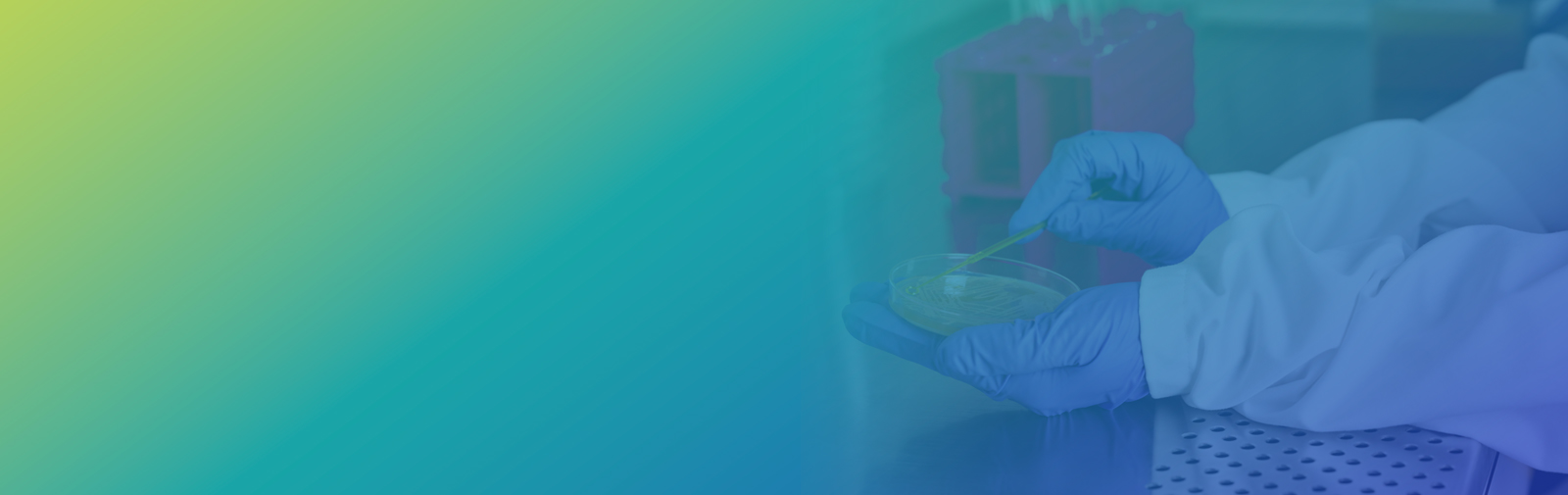 Minimum Inhibitory (MIC) and Minimum Bactericidal Concentration (MBC) Services