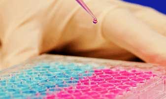 DMPK (ADME & Bioanalytical)