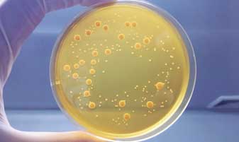Pharmaceutical Microbiology Testing