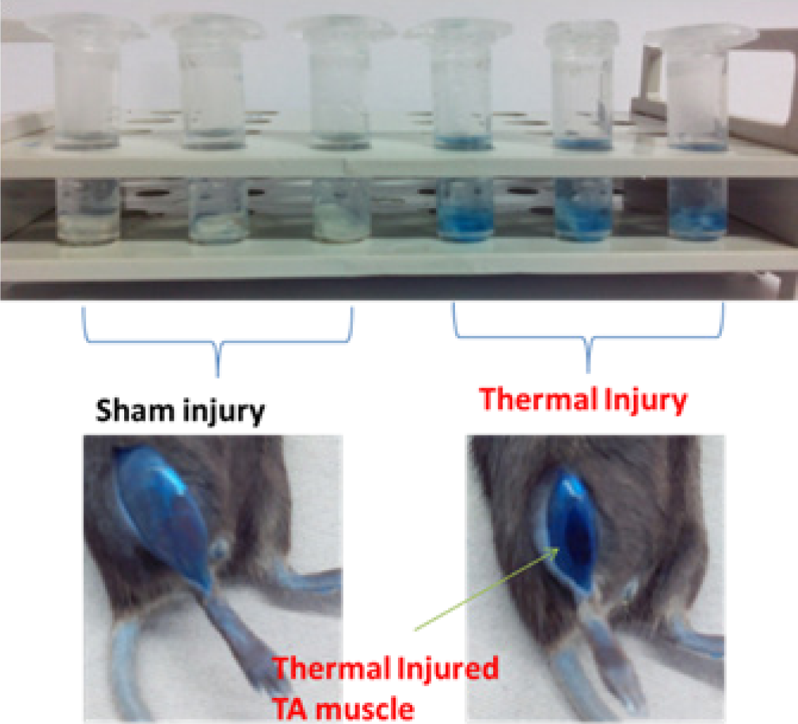 Quick quantification method for muscle injury